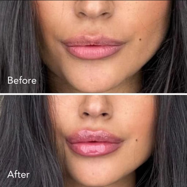 🔥👄 IL LIP PLUMPER PIÙ VIRALE DEL MOMENTO SOLD OUT IN MENO DI 24h.